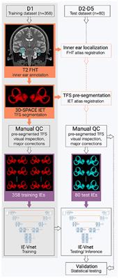 IE-Vnet: Deep Learning-Based Segmentation of the Inner Ear's Total Fluid Space